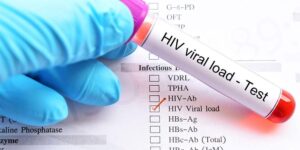 Viral Load