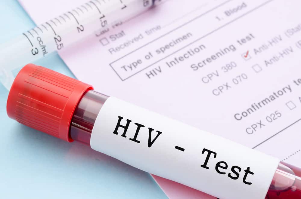 Memahami Hasil Tes Hiv Yang Perlu Anda Ketahui