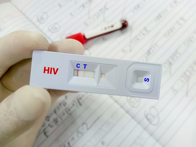 Mengenal Rapid Test Hiv Dan Efektivitasnya