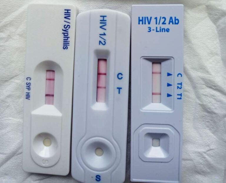 Tes HIV Di Puskesmas Dengan Rapid Test 3 Reagen Cara Dan Tingkat   Tes HIV Di Puskesmas Dengan 3 Reagen 768x623 